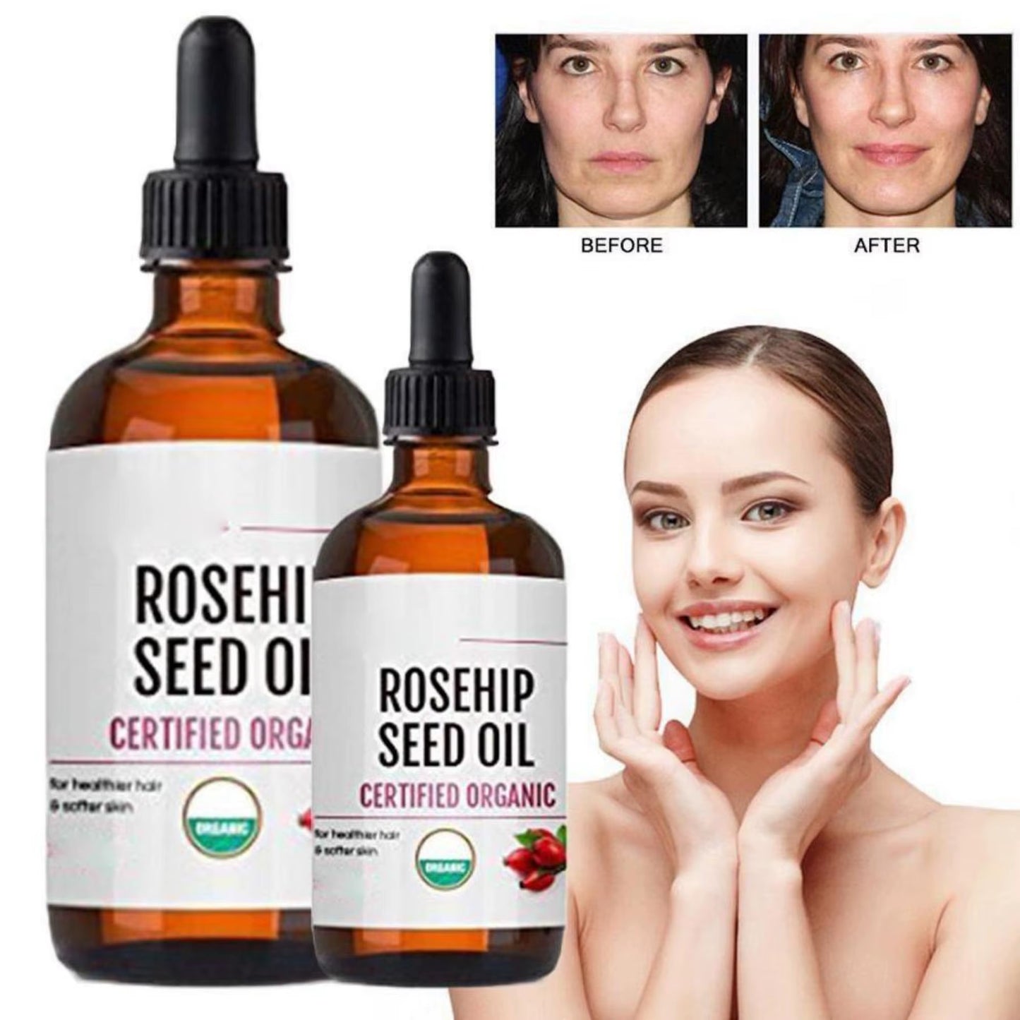 Moisturizing Rosehip Oil Oil Massage Skin Care Plant Essential Oil Moisturizing Whitening Essential Oil