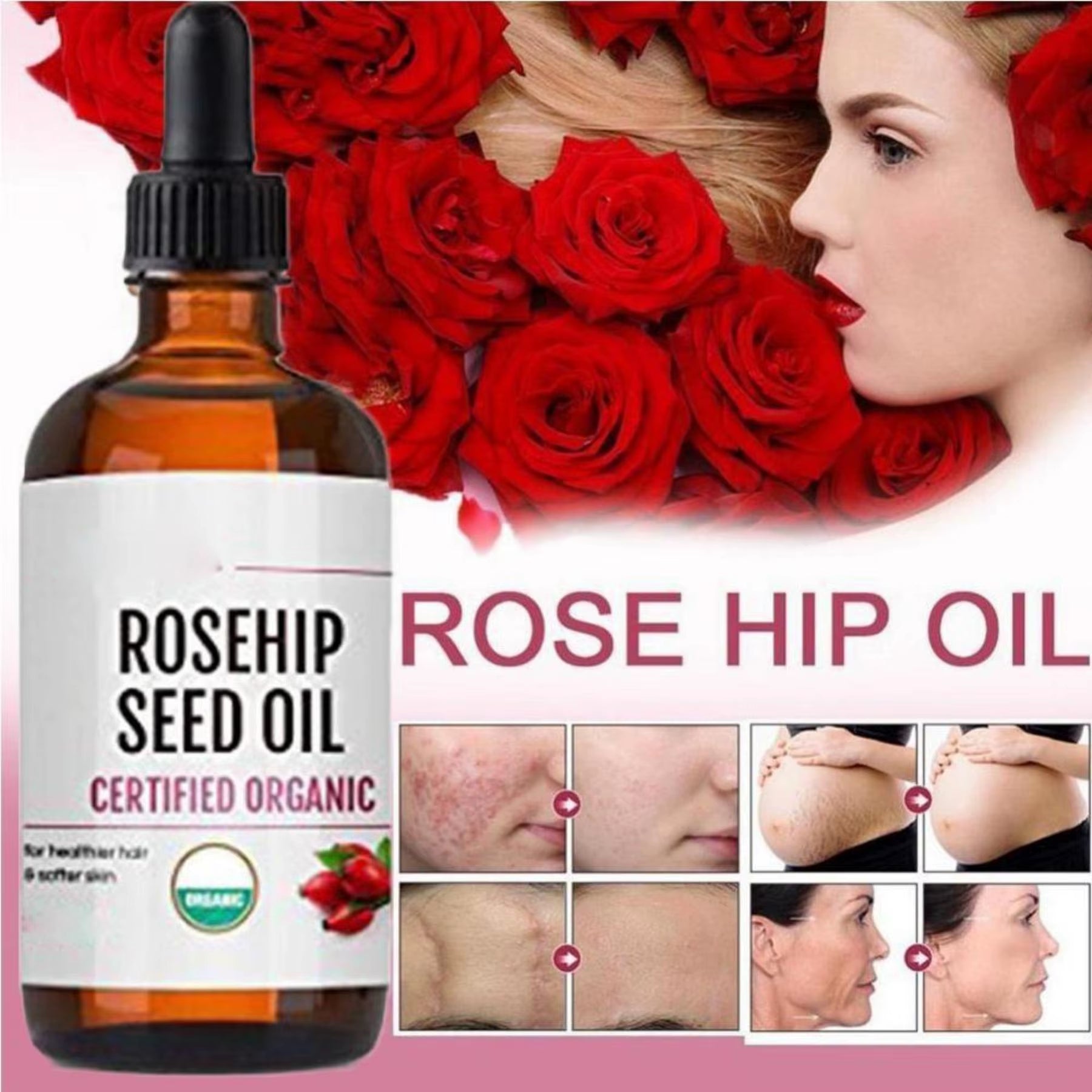 Moisturizing Rosehip Oil Oil Massage Skin Care Plant Essential Oil Moisturizing Whitening Essential Oil